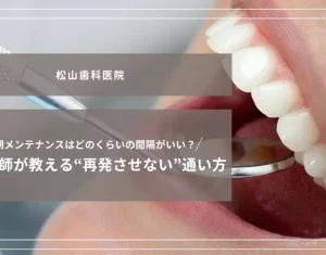 2026年2月20日_定期メンテナンスはどのくらいの間隔がいい？歯科医師が教える“再発させない”通い方