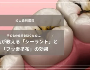 2026年7月24日_子どもの虫歯を防ぐために。院長が教える「シーラント」と「フッ素塗布」の効果