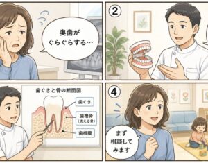 歯がぐらぐらして抜けそう！抜歯を避けて残す判断基準と受診目安