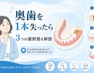 奥歯を1本失った時の治療法は？放置リスクや3つの選択肢を解説