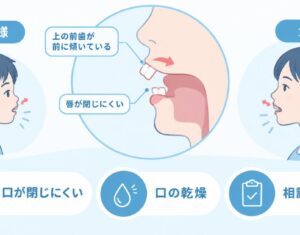 出っ歯で口が閉じない原因とは？親子で知るリスクと相談の目安