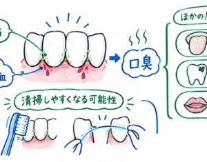 歯並びと口臭は関係ある？歯ぐきの出血と矯正で期待できること