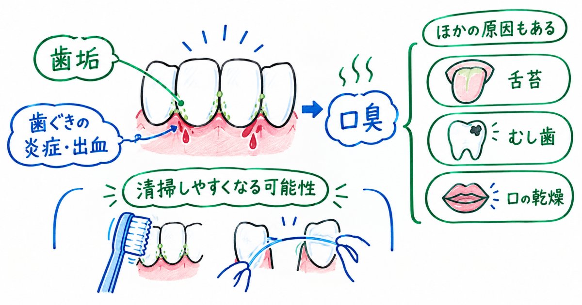 歯並びと口臭は関係ある?歯ぐきの出血と矯正で期待できること
