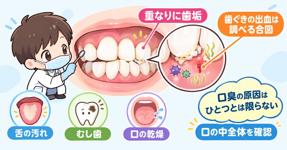 歯並びの乱れは、なぜ口臭につながることがある?